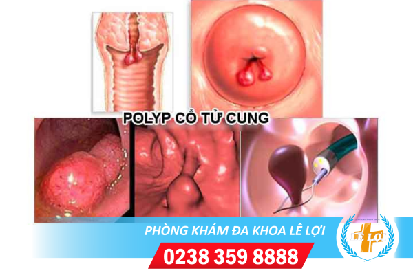 Nội Dung đoạn Văn Bản Của Bạn - 2024-04-23t160143.785