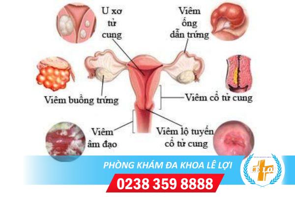 Khong-co-kinh-tac-kinh-nguyet-phai-lam-sao-1