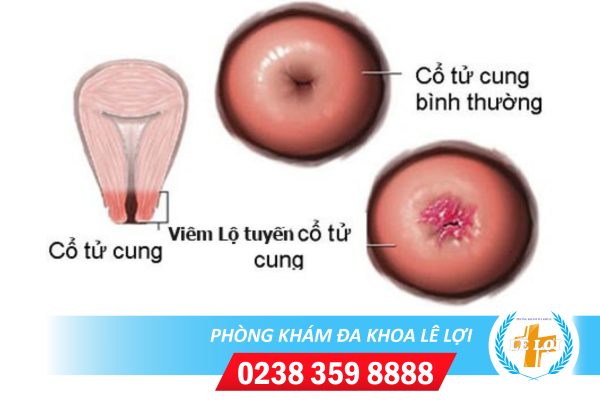 Nội Dung đoạn Văn Bản Của Bạn - 2024-04-23t144657.915