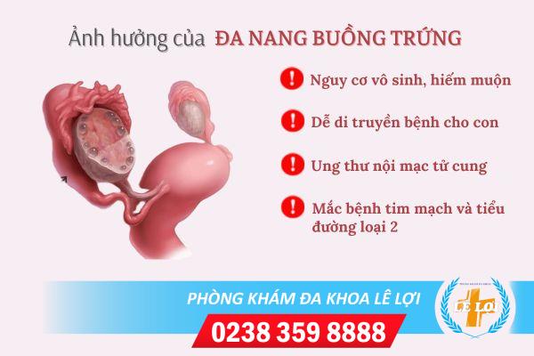 Cach-phat-hien-buong-trung-da-nang-va-giai-phap-dieu-tri-hieu-qua-2