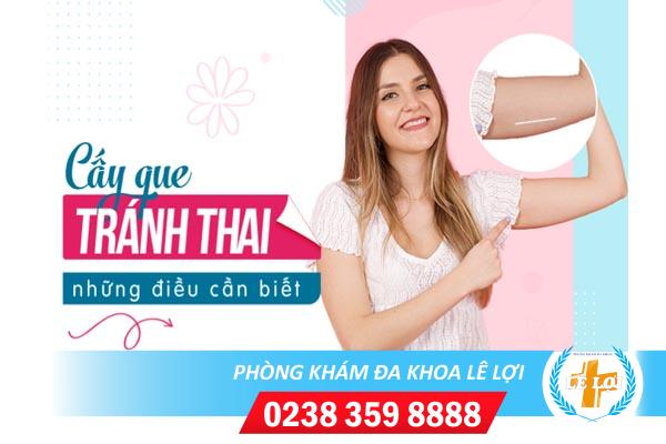 Cay-que-tranh-thai-the-nao