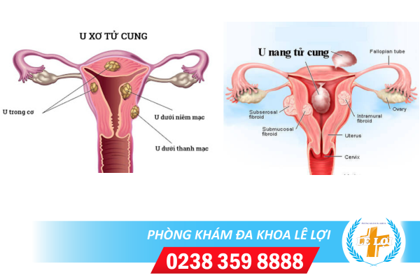 Ảnh BÀi ViẾt - 2024-04-22t163555.221