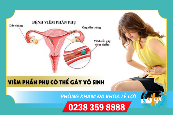 Viêm Phần Phụ Có Thể Gây Vô Sinh