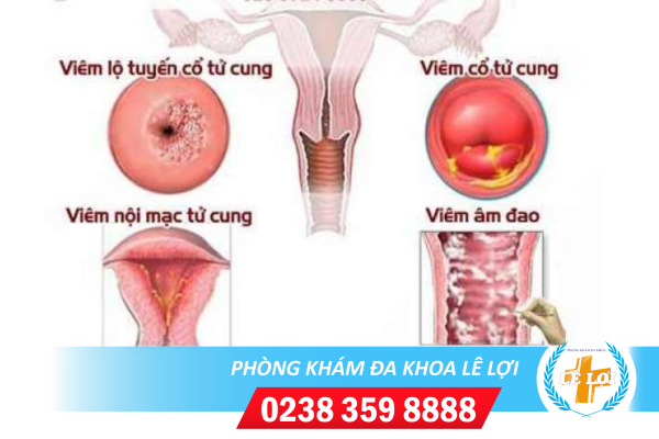 Nội Dung đoạn Văn Bản Của Bạn - 2024-04-23t151127.693