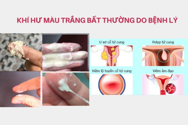 Khi-hu-mau-trang-bat-thuong