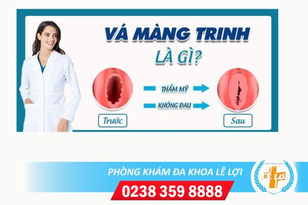 Va-mang-trinh-phong-kham-vinh