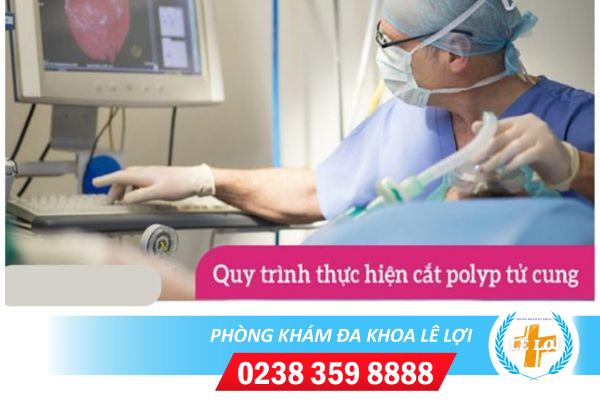 Cat-polyp-co-tu-cung-co-hieu-qua-va-an-toan-khong-2