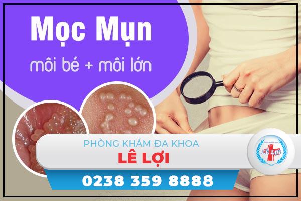 het-suc-luu-y-tinh-trang-moc-mun-moi-be-moi-lon-1