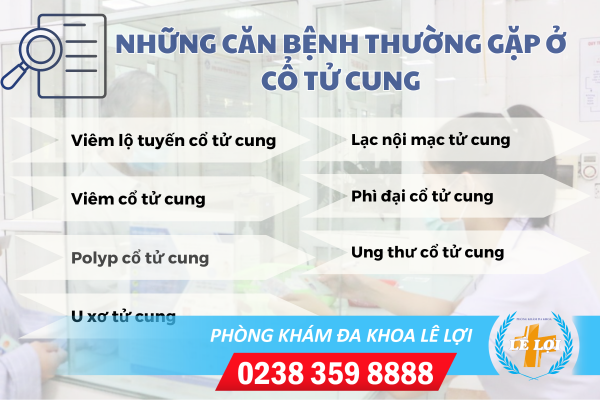 Nhung-can-benh-thuong-gap-o-co-tu-cung