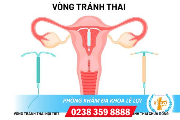 Cac-loai-vong-tranh-thai