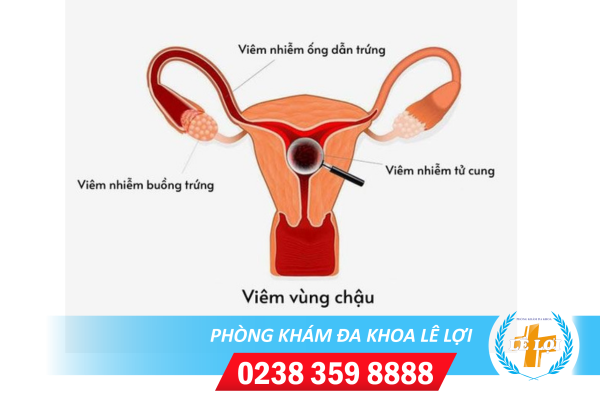 Nội Dung đoạn Văn Bản Của Bạn - 2024-04-23t145521.465