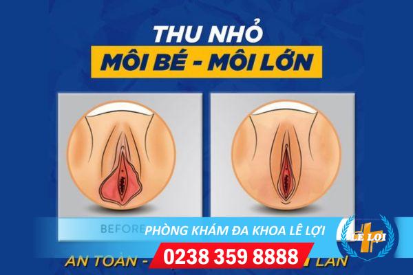 Thu-hep-moi-be-moi-lon