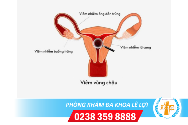 Nội Dung đoạn Văn Bản Của Bạn - 2024-04-24t102247.418