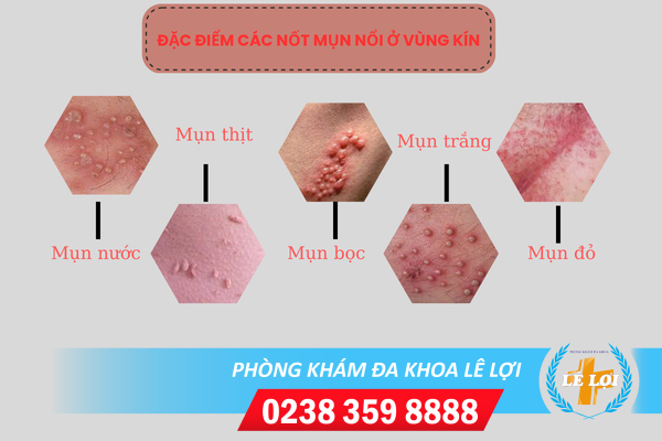 Nội Dung đoạn Văn Bản Của Bạn