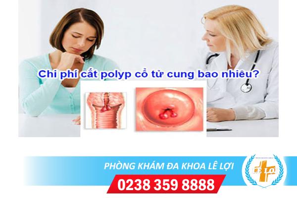 Chi-phi-cat-polyp-co-tu-cung