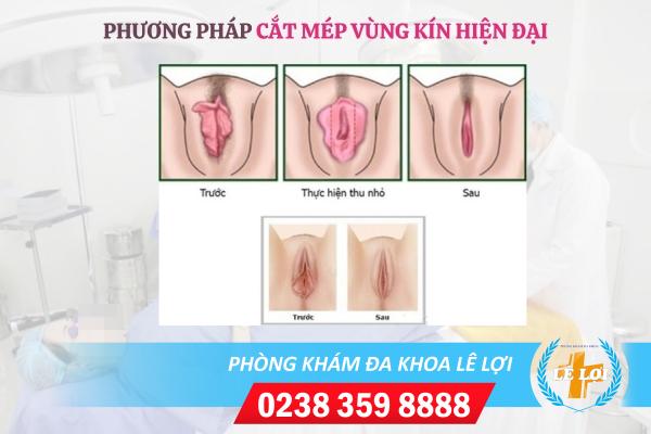 Cat-mep-vung-kin-dau-khong