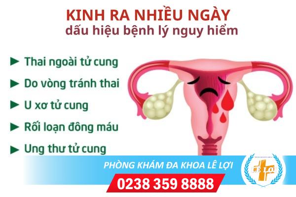 Kinh-ra-nhieu-ngay-nguyen-nhan