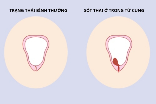 Sot-thai