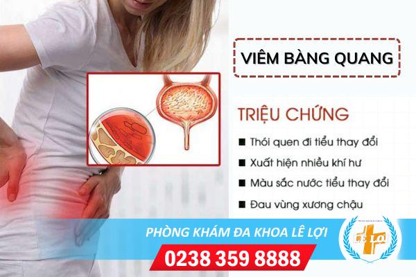 Dia-chi-chua-viem-bang-quang-1